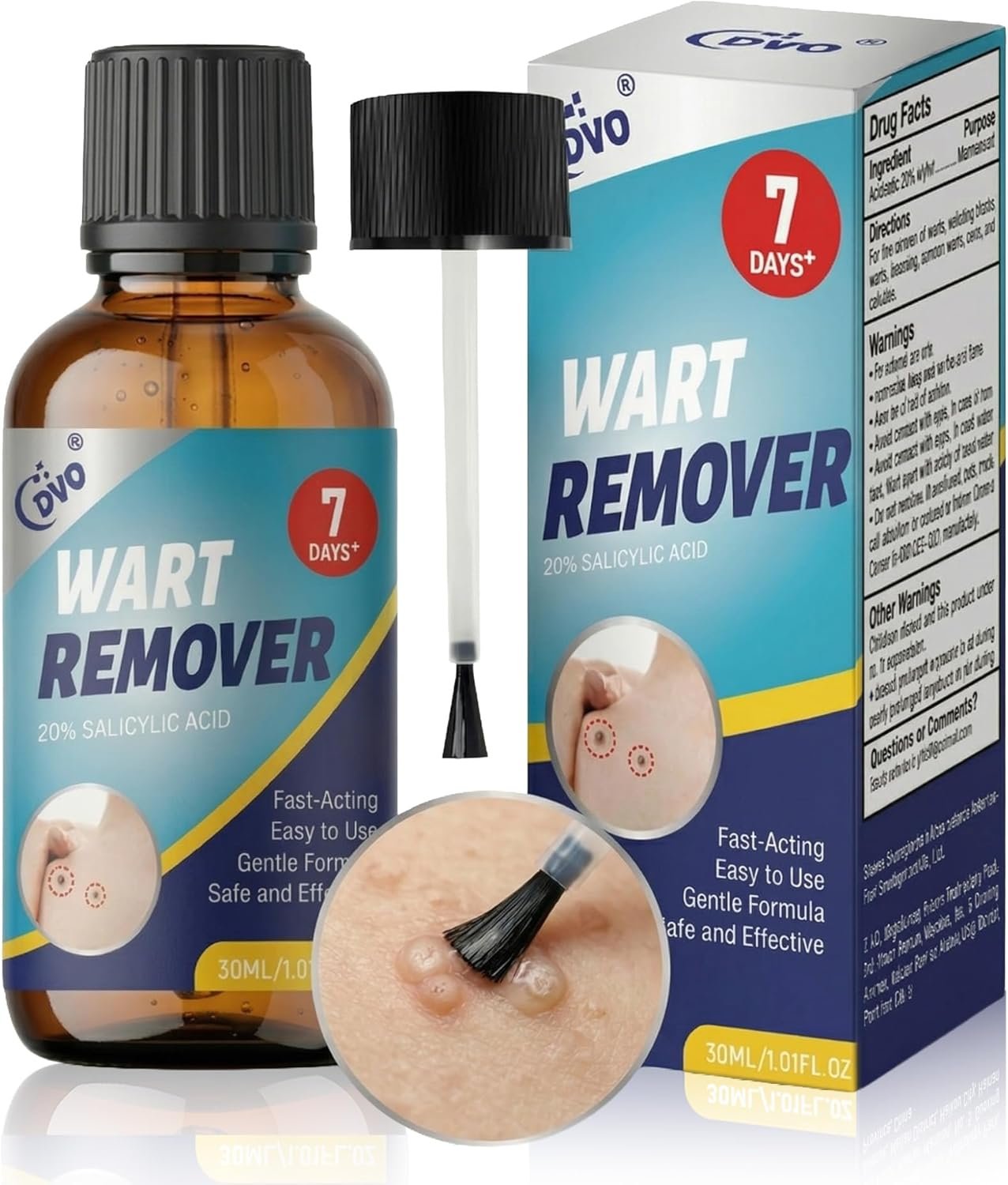 DVO 20% Salicylic Acid Wart Remover Liquid, Maximum Strength Fast-Acting, Painless Wart Removal, Common & Flat Warts, Foot Corn, for Men & Women, 30ML